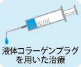 液体コラーゲンプラグを用いた治療